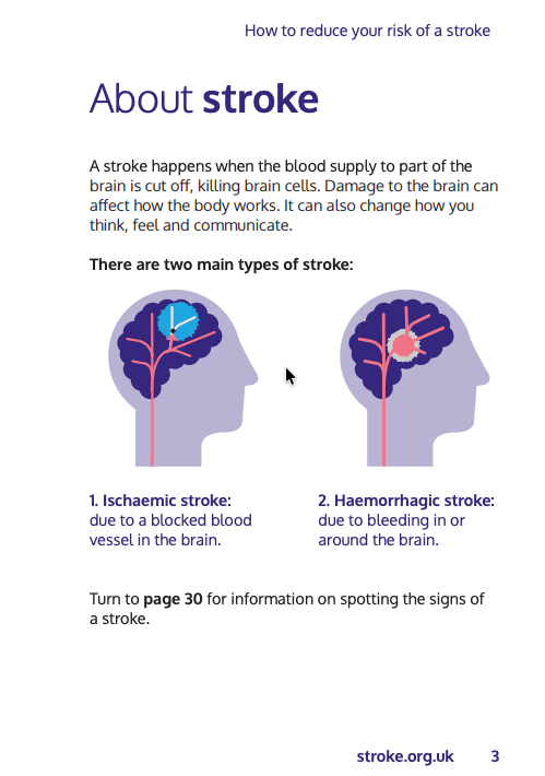How to reduce your risk of a stroke guide - Image 2